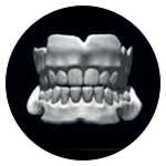 Vollprothese - CORiTEC 650i PRO Serie