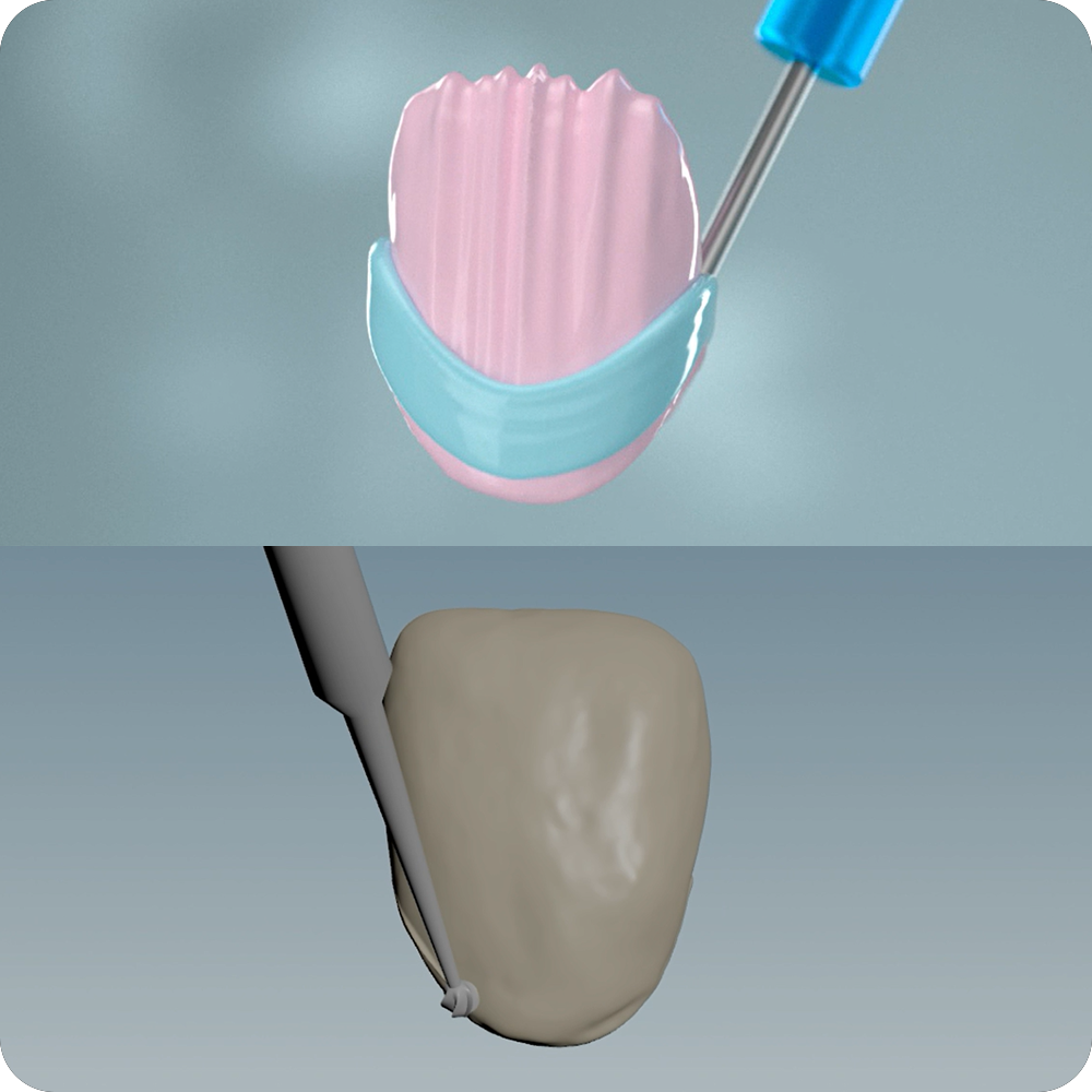 additiv und subtraktiv