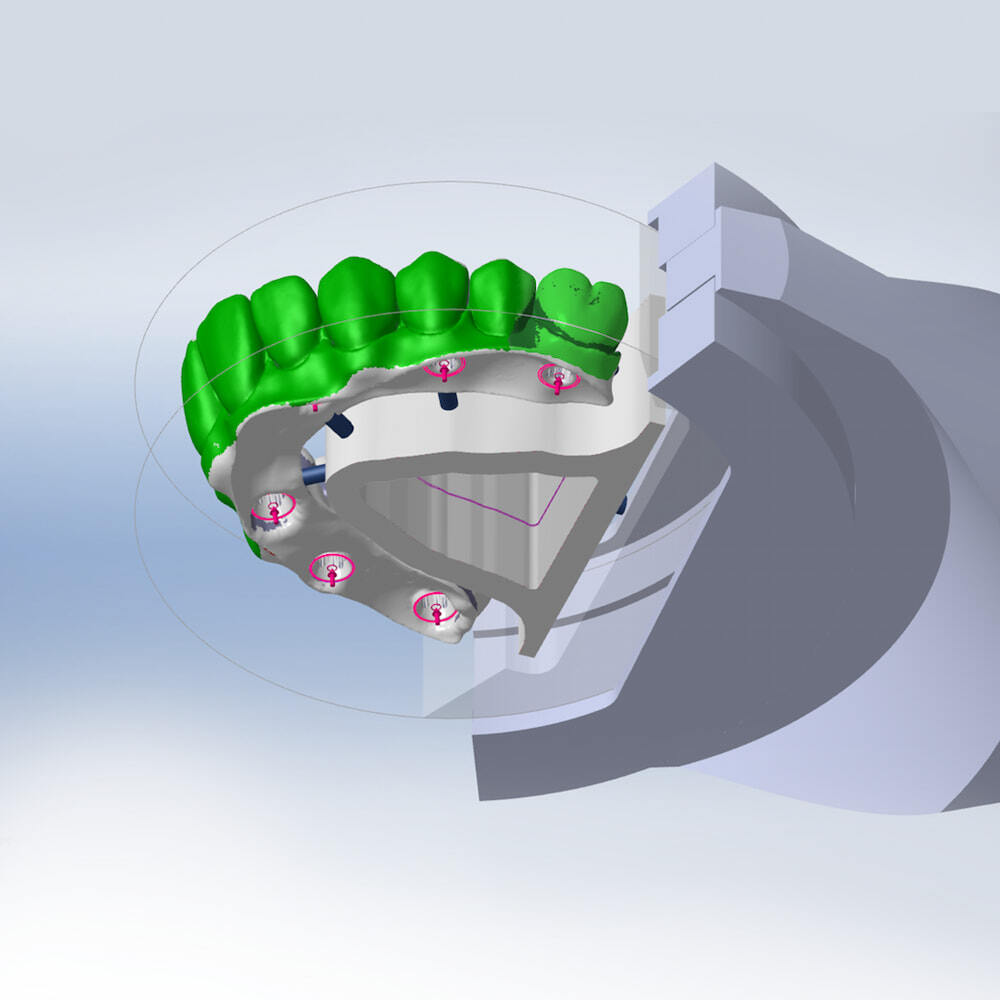 12-unit-bridge-02-CAM