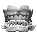 Full denture