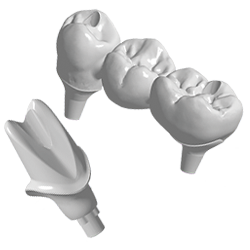 Abutments